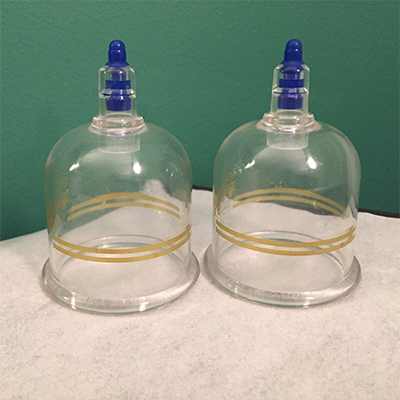 Cupping_2_400